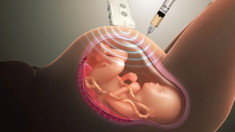 prenatalnaya diagnostika 1 768x432 1