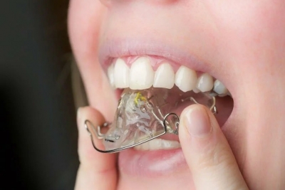 Ортодонтические пластинки — надежный метод исправления неправильного прикуса у детей