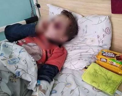 На Вінниччині 6-річну дитину з синцями і побоями доправили до лікарні. В катуванні підозрюють батька